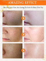 5PCS Joy Pretty Vitamin C Whitening Skin Care Set